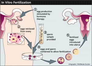 In-Vitro-Fertilization